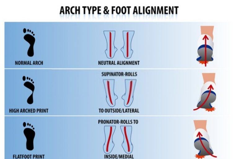 The Benefits and Importances of Arch Support Sneakers for Foot Pain