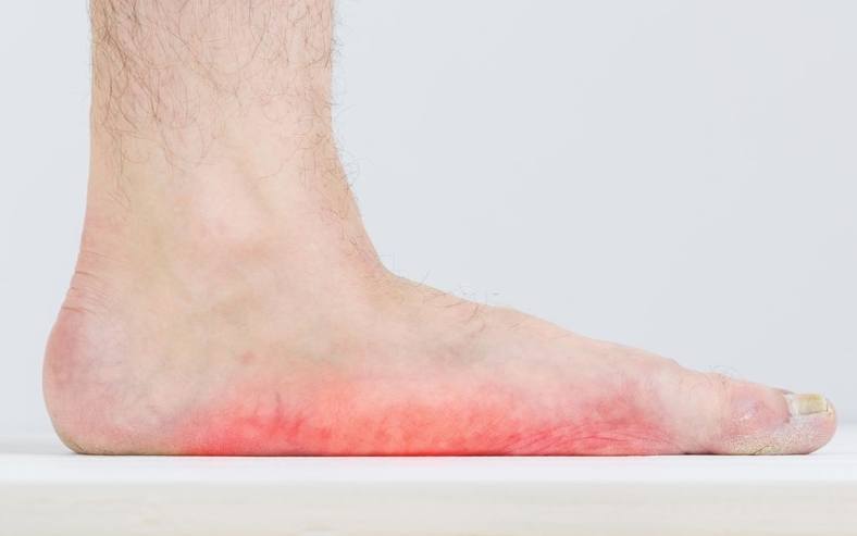 Can You Get Into The Military With Flat Feet? - Hood MWR