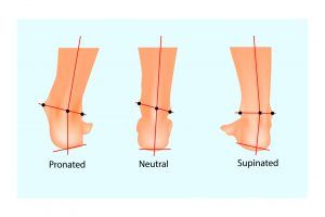 Do You Pronate or Supinate? What It Means for the Foot - HoodMWR