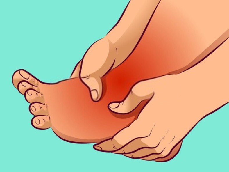 Obesity And Common Foot Conditions