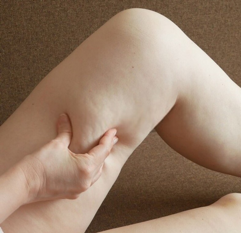 Leg Problems Associated With Being Overweight