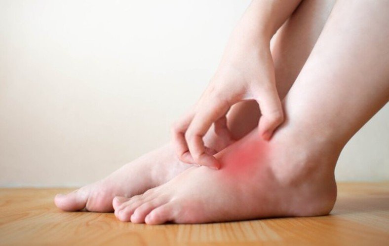 How Can I Prevent Itchy Feet?