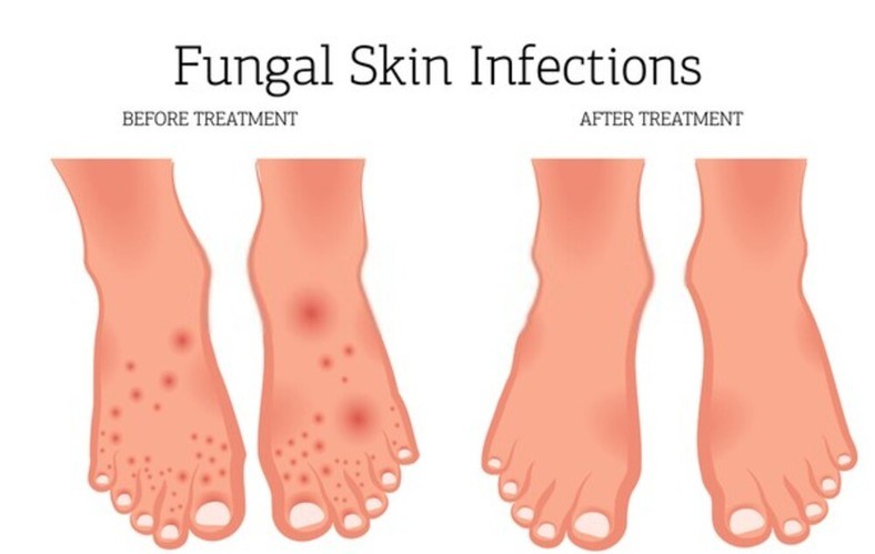 5/ Preventing Skin Conditions