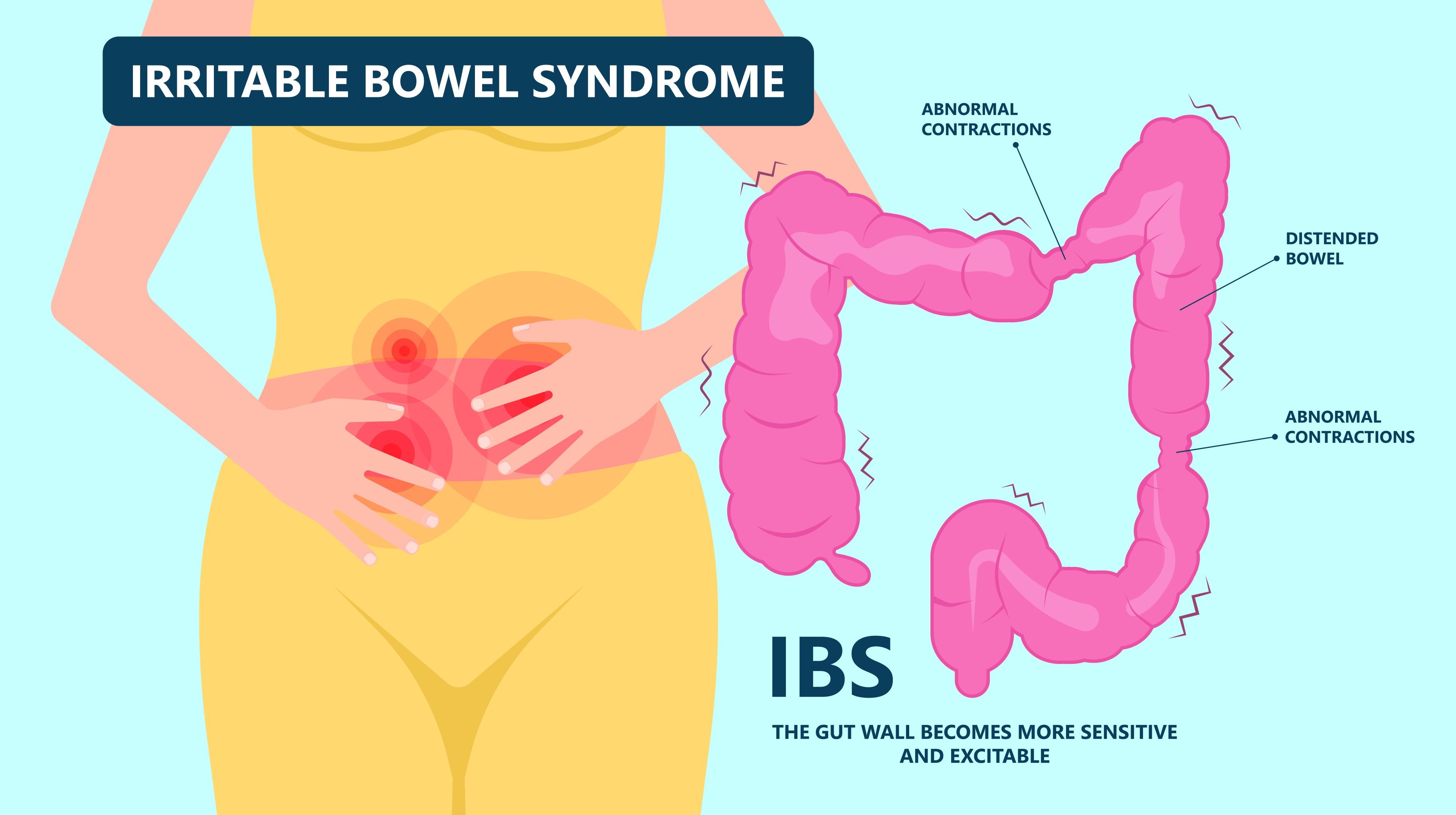 Irritable Bowel Syndrome - The Gut Becomes more Sensitve and Excitable