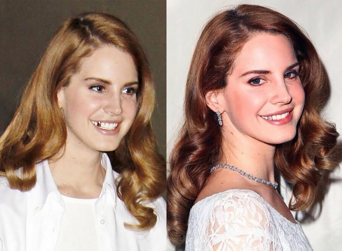 Lana Del Rey