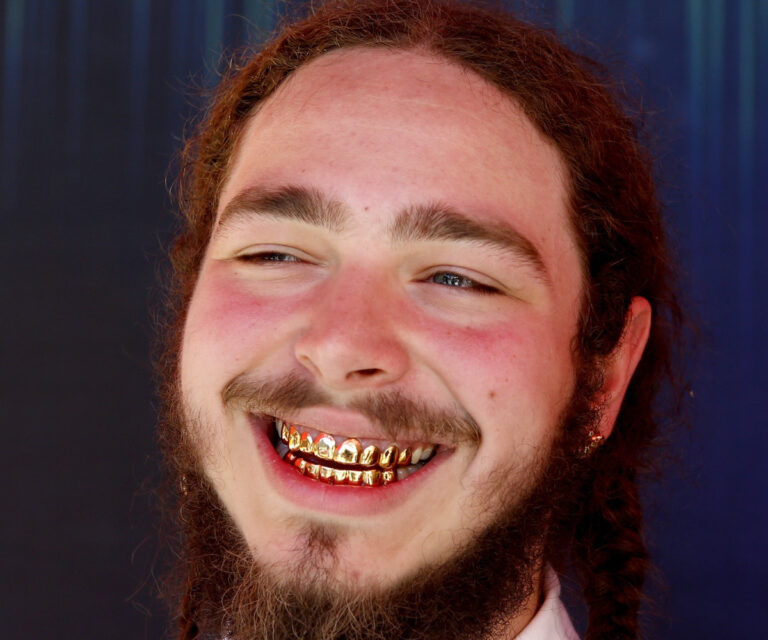 50 Famous People Decorate Their Teeth With Gems Hood MWR