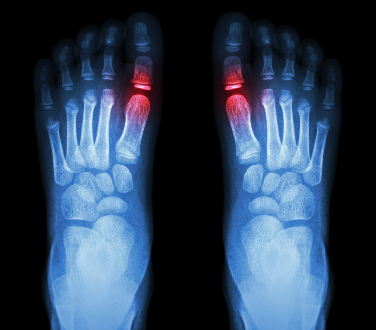 Pain in Toes When Walking Causes, Types of Pains and More Hood MWR