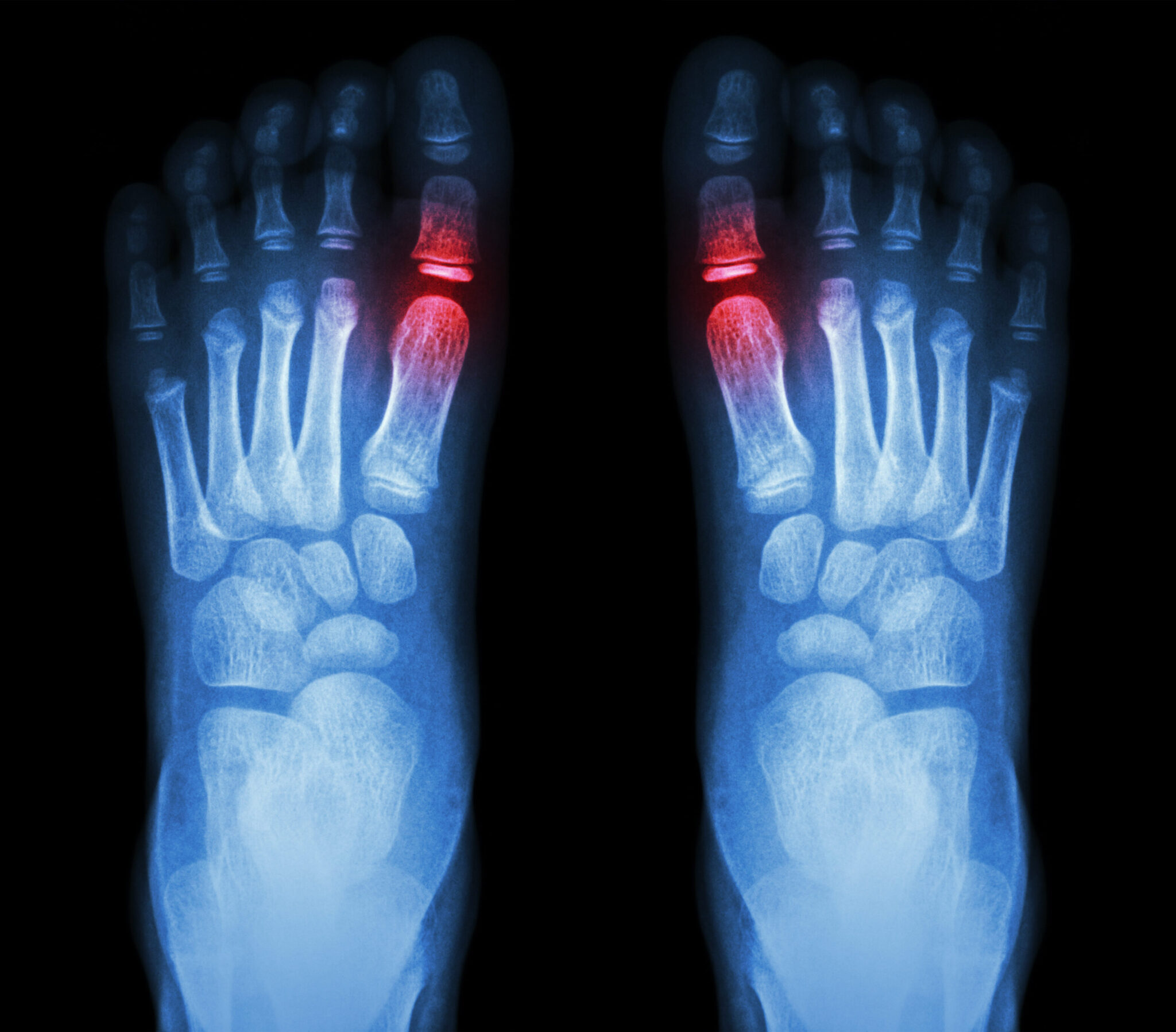 Pain in Toes When Walking Causes, Types of Pains and More Hood MWR
