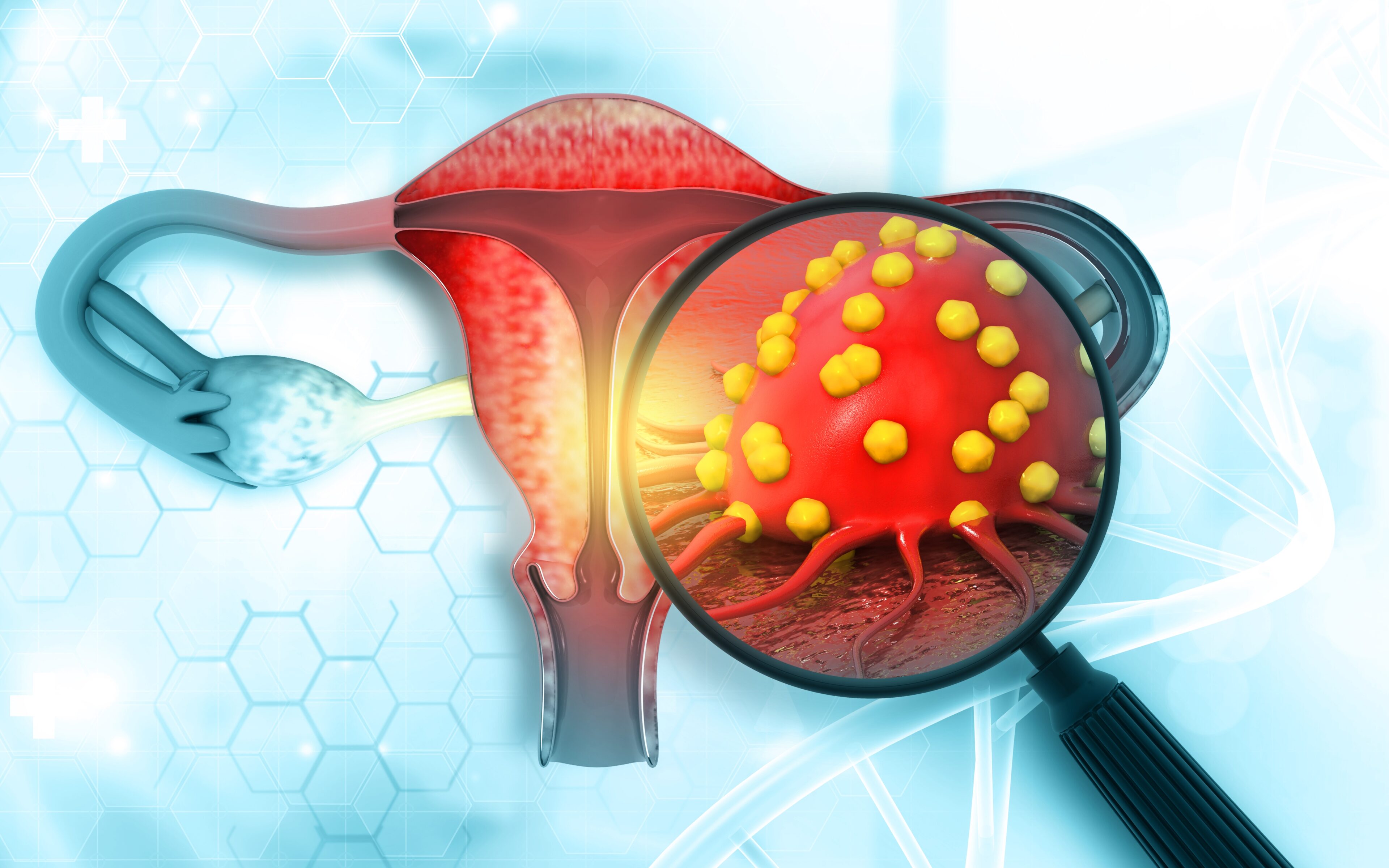 Gynecologic Disorder