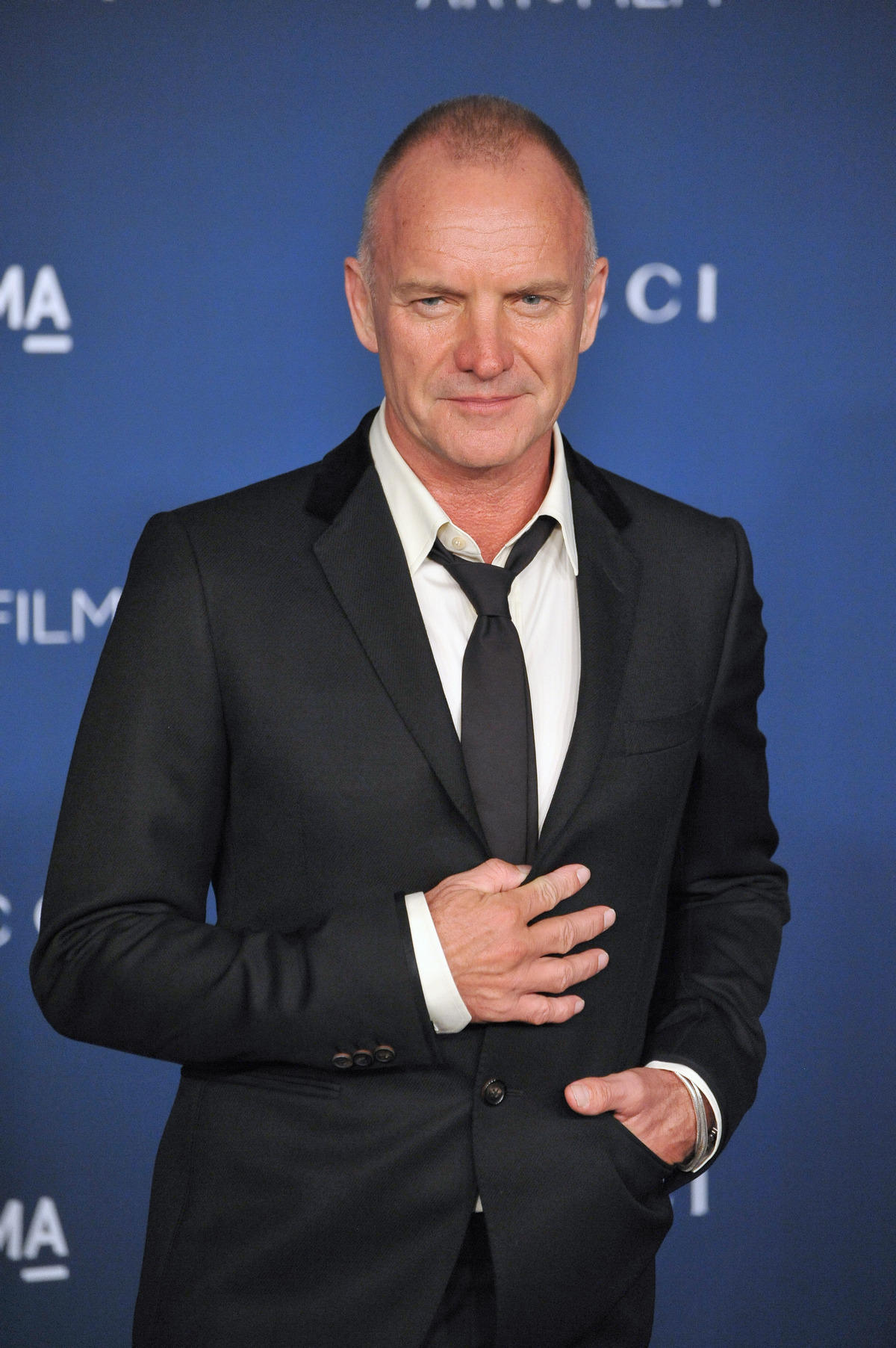 Sting