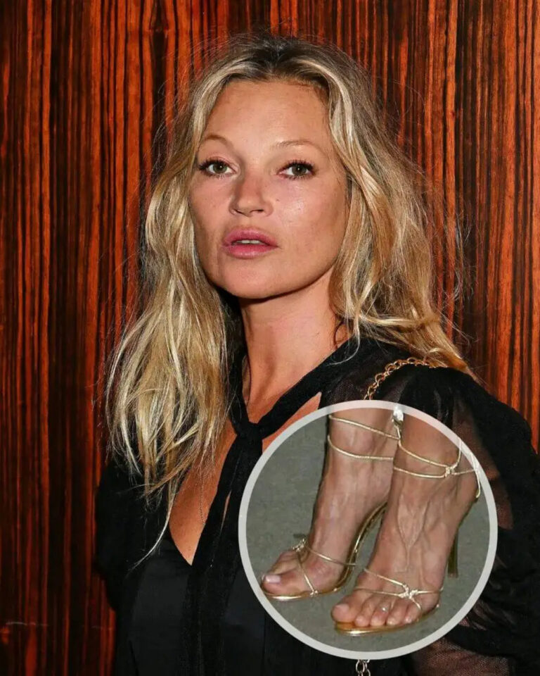 50 Celebrities with Bunions (Updated 2023) Hood MWR — free download