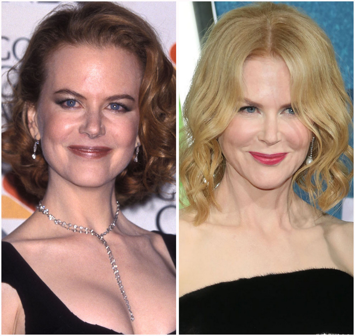 Nicole Kidman