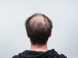 36 Ugly Haircuts You Should Avoid 