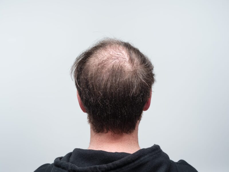 36 Ugly Haircuts You Should Avoid 