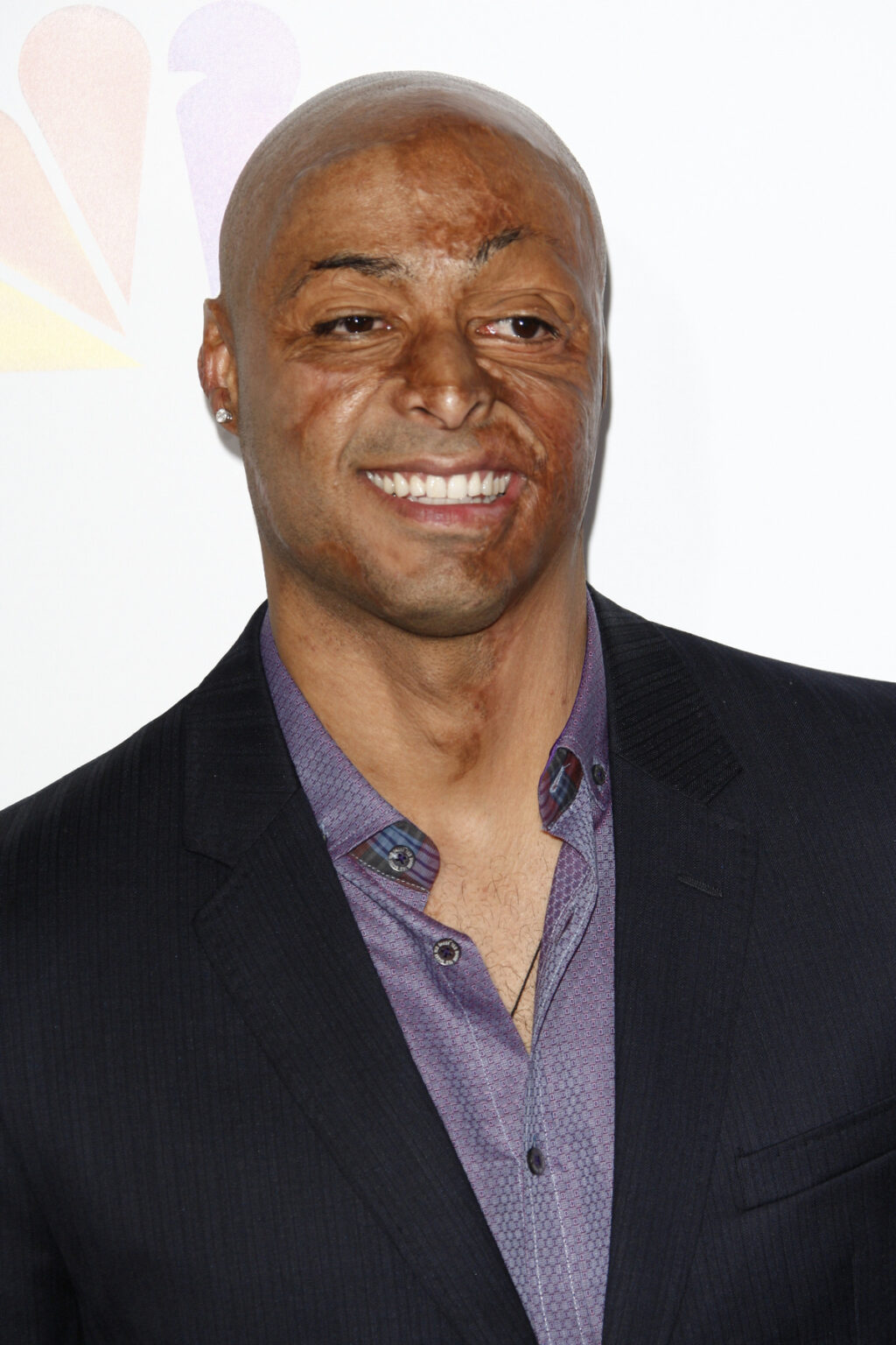 Top 50 Inspiring Cleft Lip and Palate Celebrities - Hood MWR