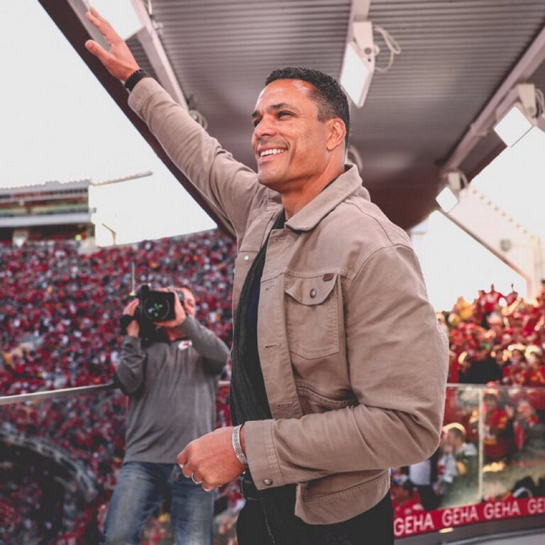 50 Celebrities With Bell's Palsy - Hood MWR