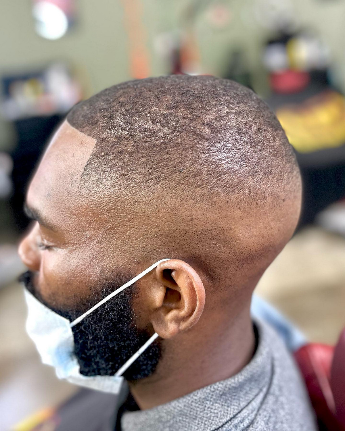 High Bald Fade Haircut