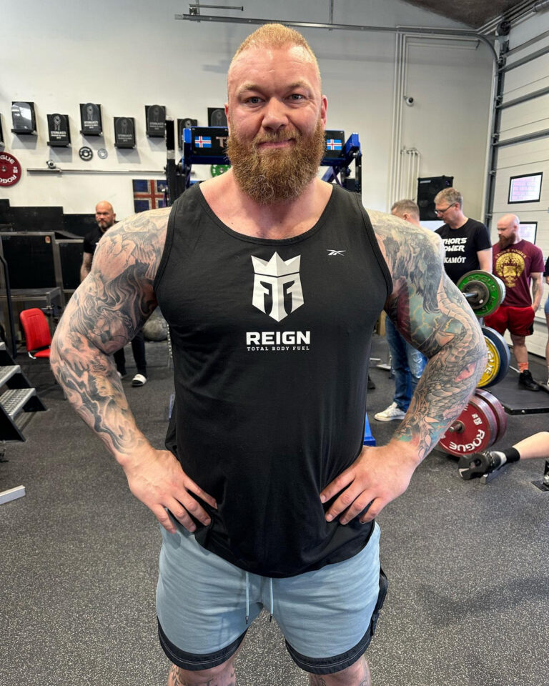 50 Celebrities With Bell's Palsy - Hood MWR