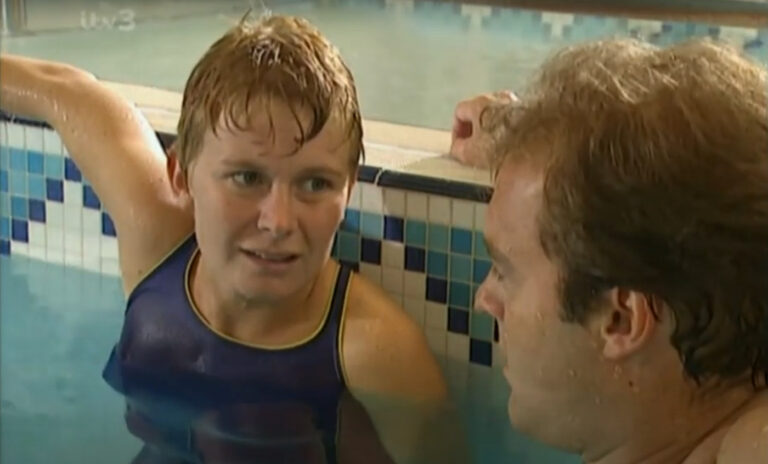 50 Celebrities With Bell's Palsy - Hood MWR