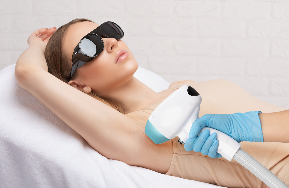 Elos epilation hair removal procedure on a woman’s body