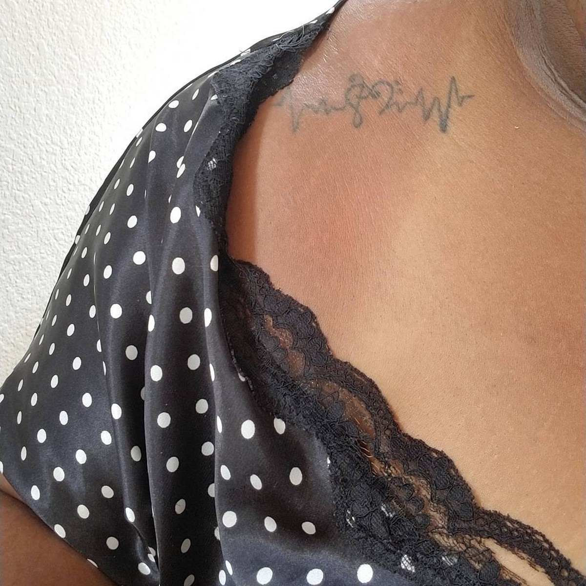 Black Redhead With Sunburn