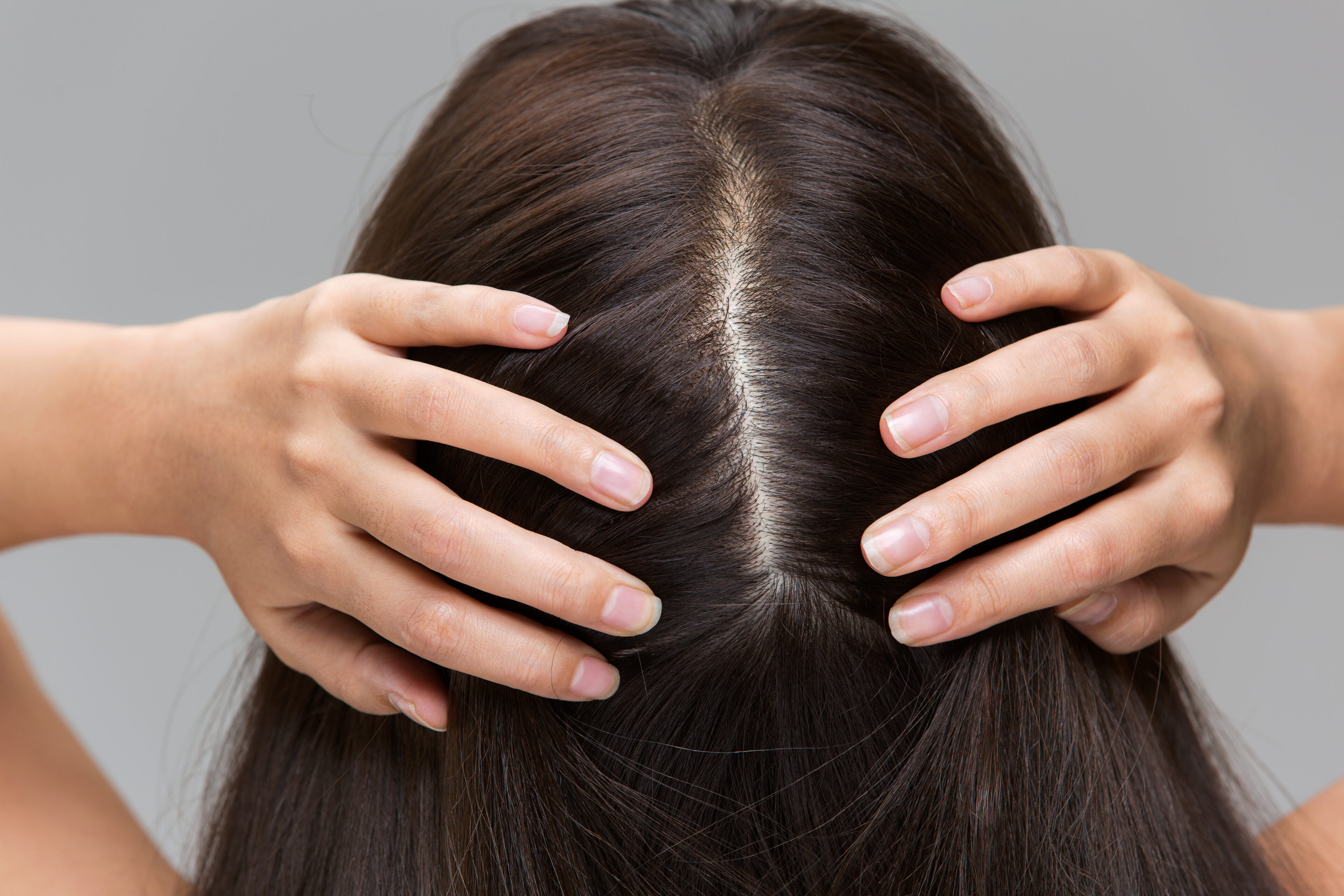 Regularly clean your scalp with authorized shampoo