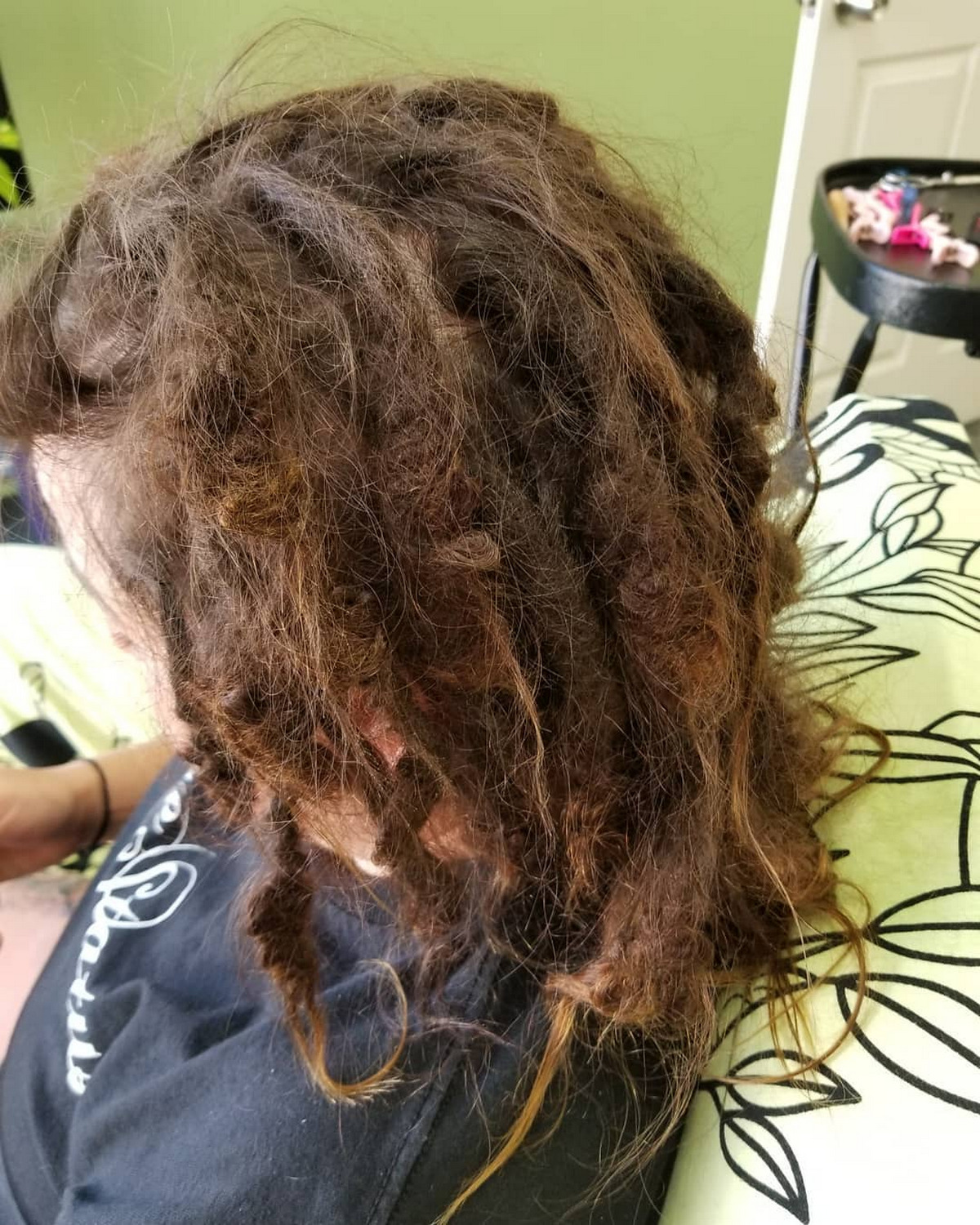 Natural/Neglect Method