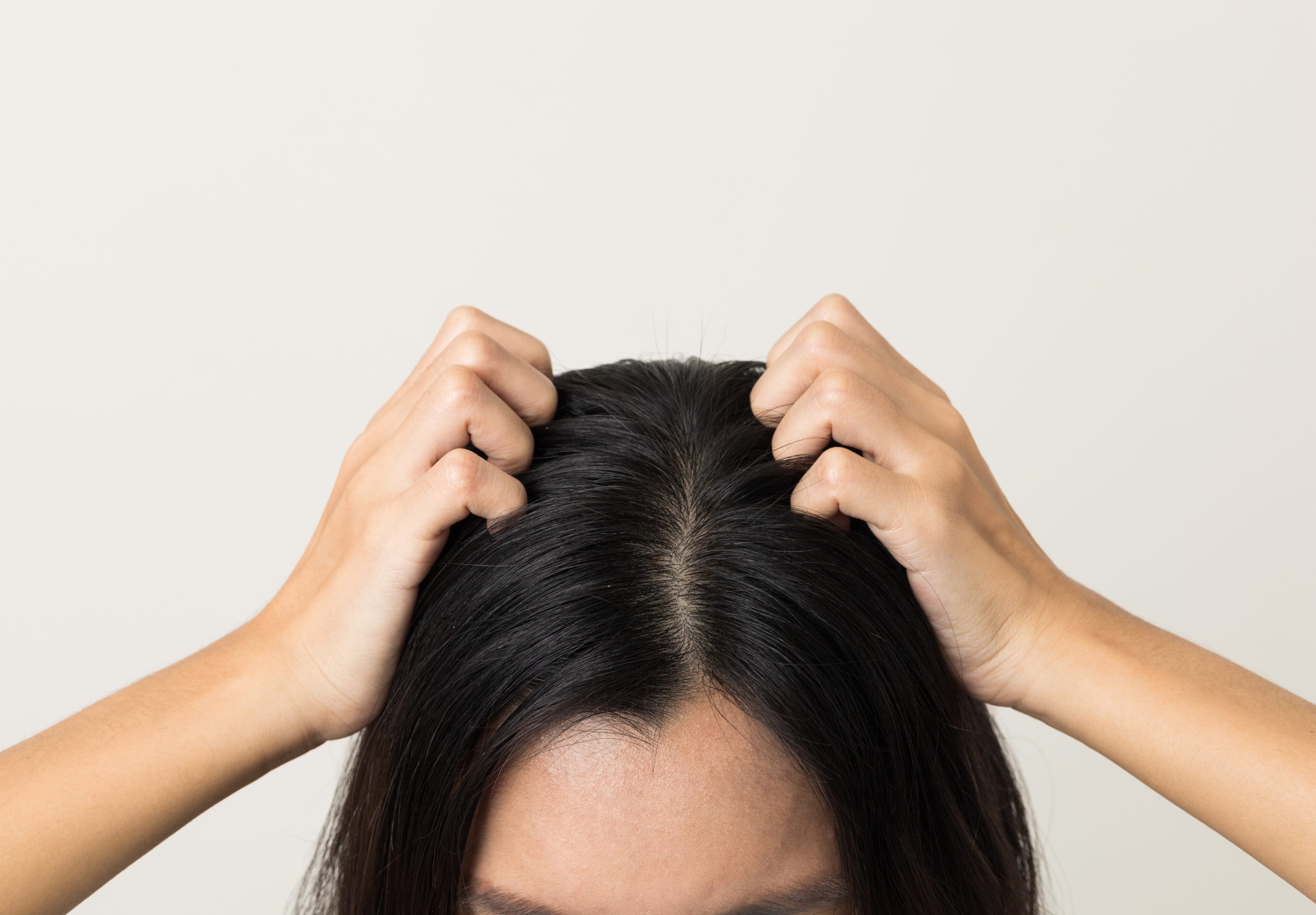 Scalp Irritation