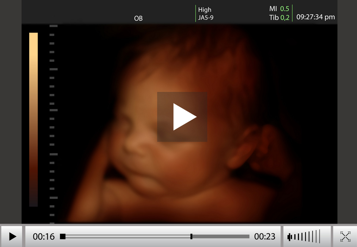 The 4D ultrasound images of the baby boy soon to be born