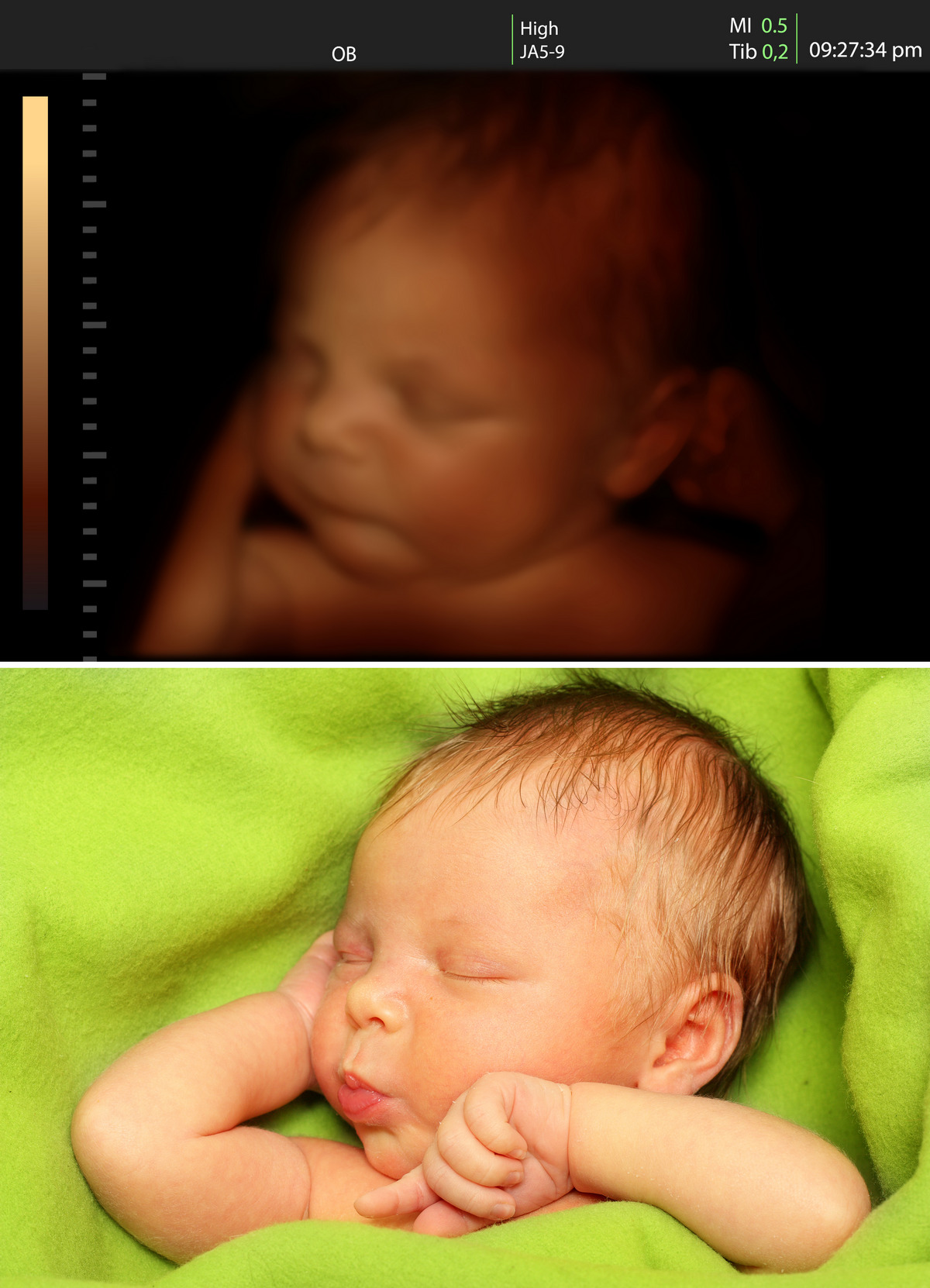 The newborn's hair may not look exactly on ultrasound, parents!