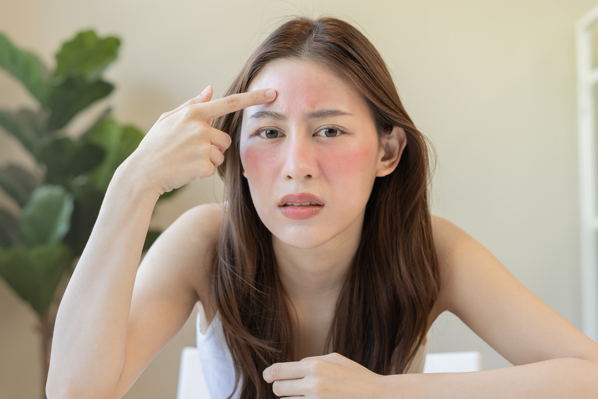 Allergy presenting an allergic reaction from cosmetic