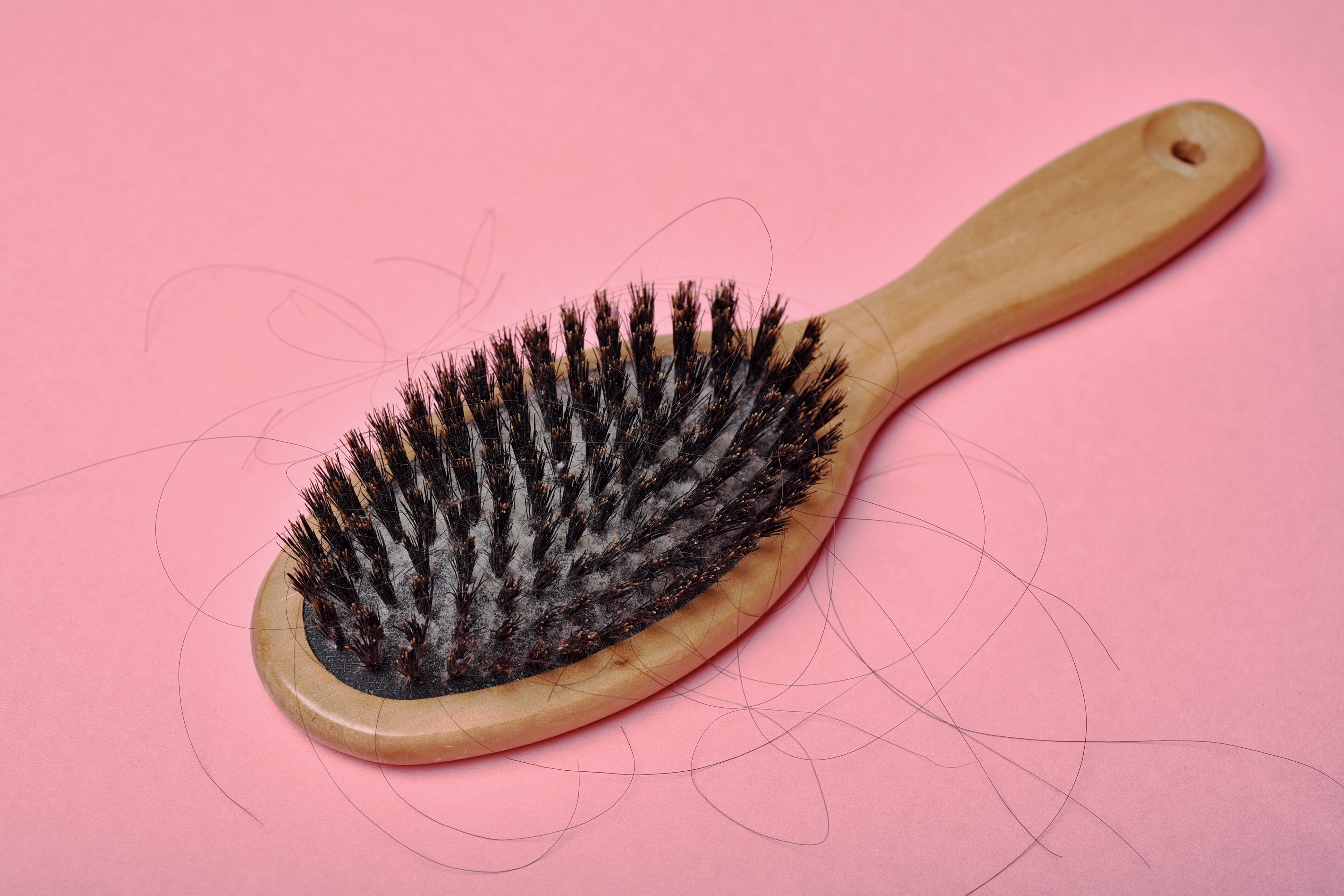 Dead Skin Cell Residue On The Unclean Comb