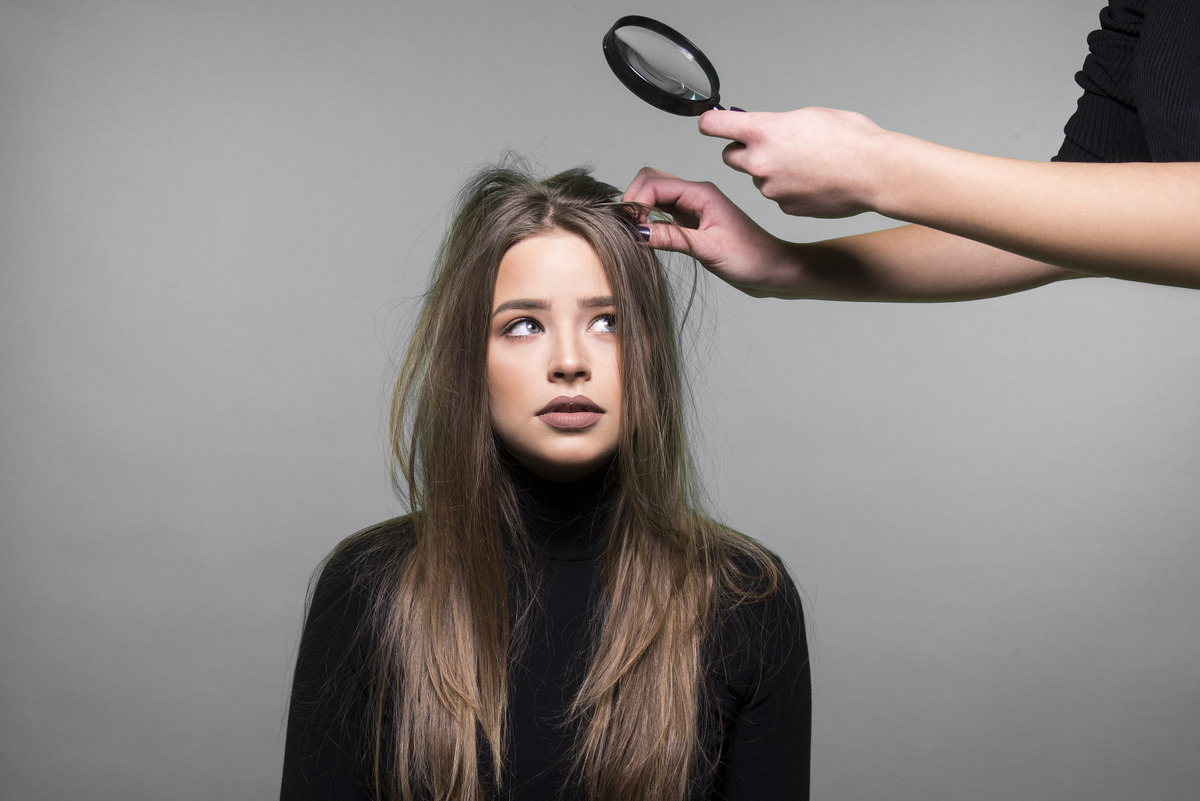 Cases of dandruff must consult a professional