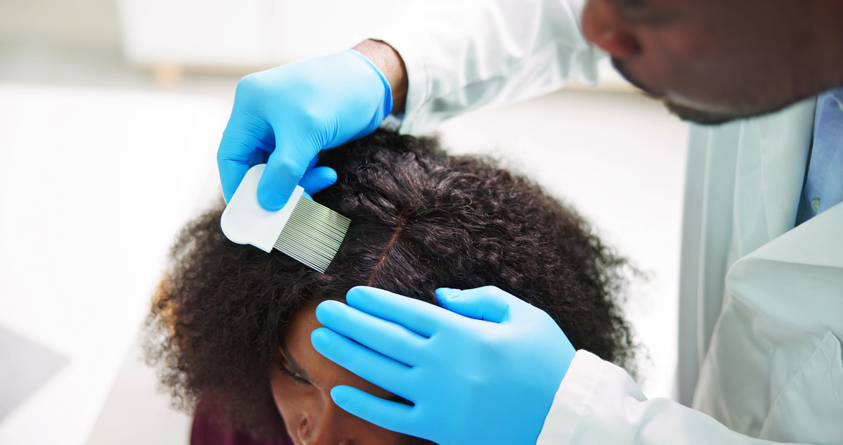 Cleanse your hair and scalp regularly