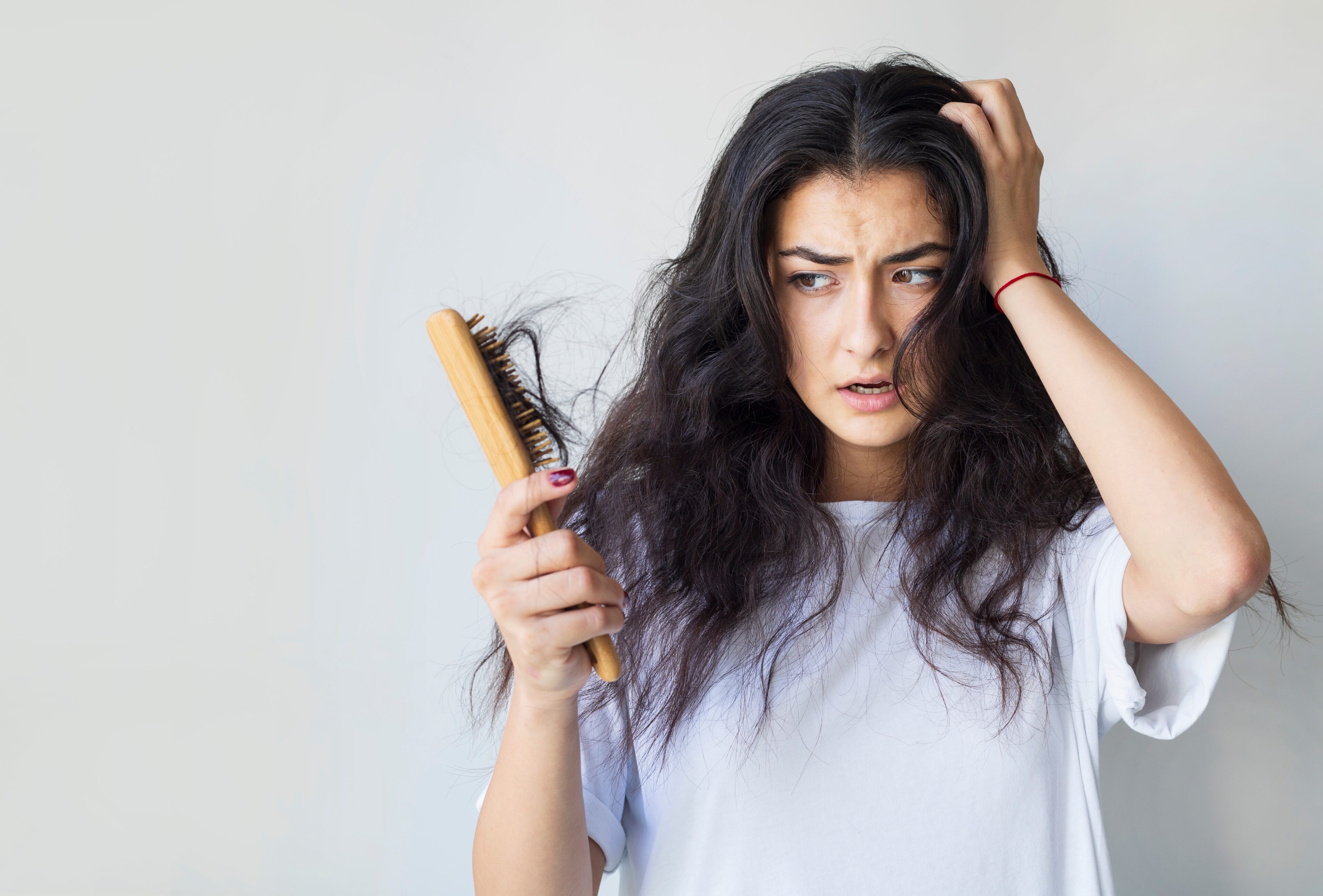 A Woman With Hair Loss