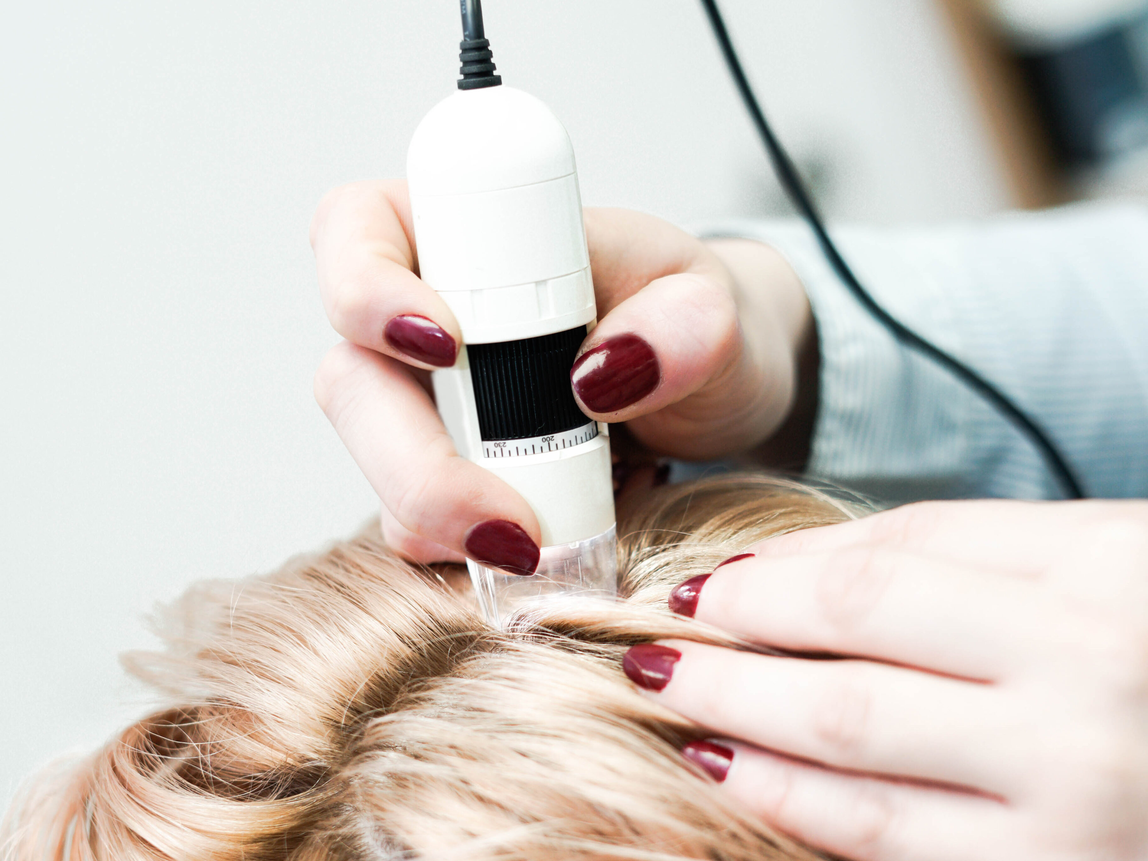 Remove any residual dye