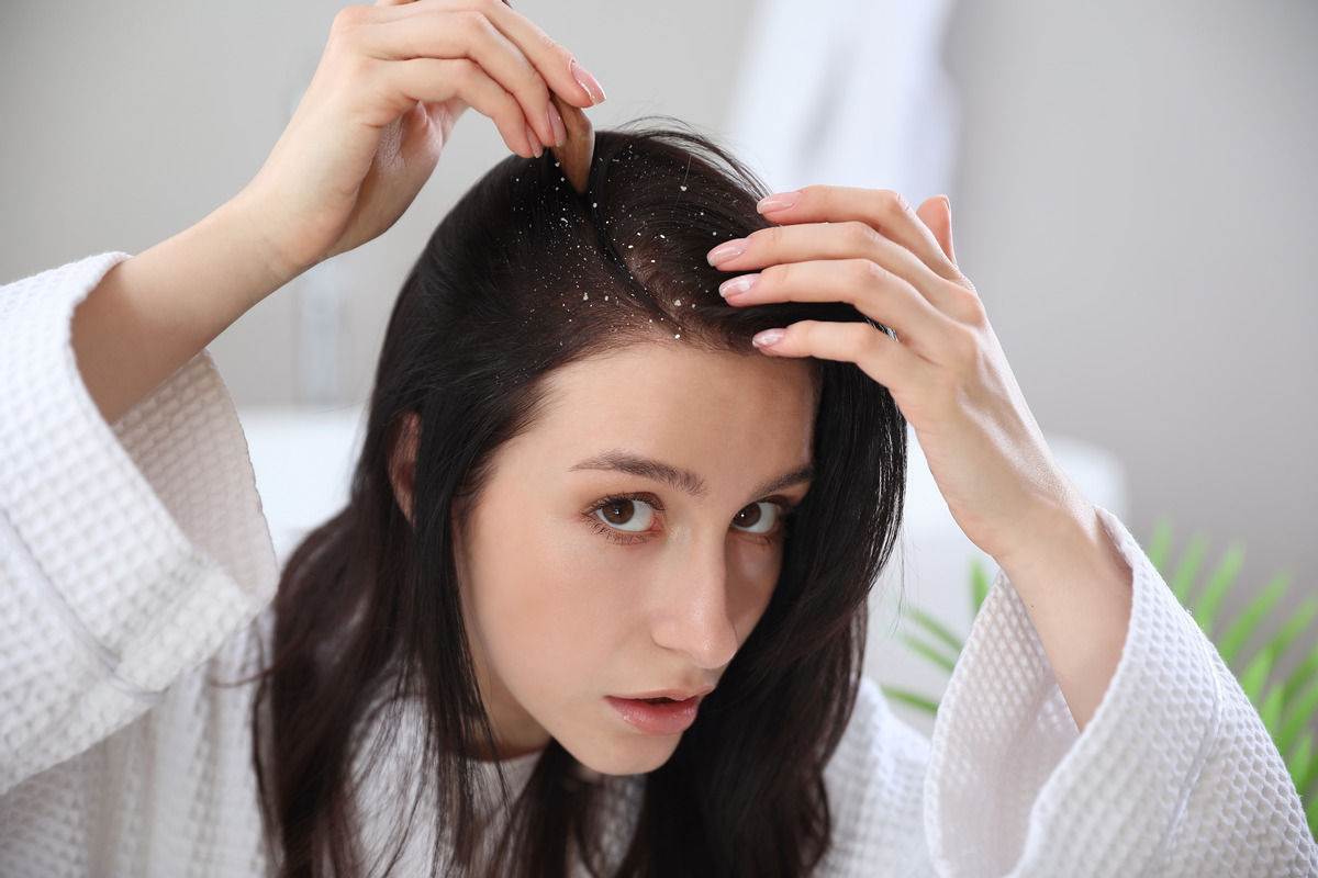Problem dandruff after washing hair