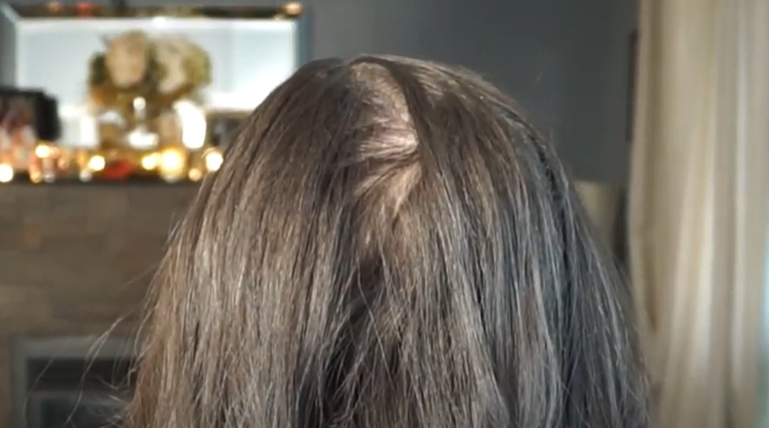 Hair parting in the back